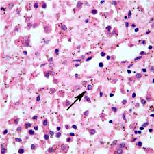 As a group they are involved in the body's defense mechanisms and reparative activity. Intranuclear Viral Inclusion In A Nucleated Red Blood Cell Placenta Download Scientific Diagram