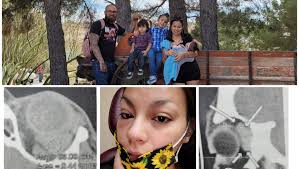 Fundraiser by Albert Villagomez : Orbital cavity tumor