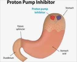 Yet it seems that every week, a new study is published showing that ppis have another nasty side effect. Indian Perspective On Rational Use Of Proton Pump Inhibitors Recommend Experts