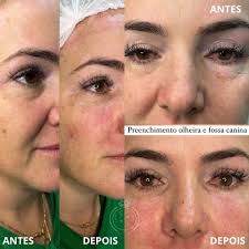 Estética Avançada em Três Pontas