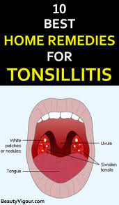 Home Remedies For Tonsillitis Tonsilitis Remedy Coconut Health Benefits Remedies