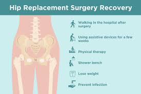 The tva muscle wraps around the torso from front to back and from the ribs to the pelvis. Hip Replacement Recovery Tips From Doctors And Patients