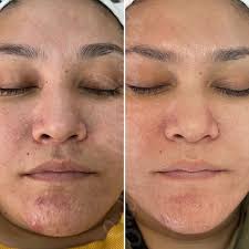 פרופיל של ‏‎Snow Aesthetics‎‏‎