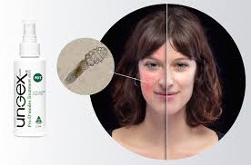 Image result for demodex rosacea