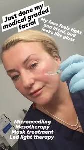 Microneedling & mesotherapy available with the MOST advanced  polynucleotide. Skin boost and vitamins