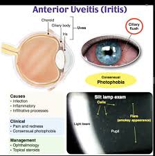 Image result for Ciliary Flush