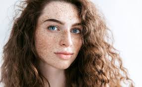 Image result for Freckled skin