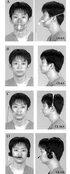 There are several different kinds of oxygen masks, depending on what the patient needs. The Oxygen Delivery Systems Tested A Hudson Face Mask Oxygenmask Download Scientific Diagram