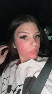 It's my first time using home tester club and I've been sent the cetaphil  cleanser. For my before and after photo does it have to be of my entire  face? Or can