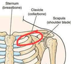 For both pain under the clavicle and in the chest area, the following causes are possible: Anyone Else Get Costo Pain Here Under Collarbone Costochondritis