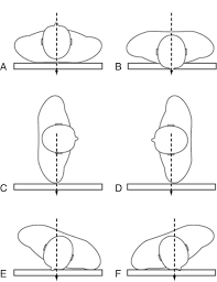 radiographic positioning radiology key