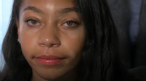 Northeast Ohio girl, her family spread awareness for vitiligo: 'This is who  I am'