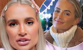 Molly Mae Hague says she looks five years younger after getting fillers  dissolved