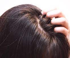 How to reverse gray hair naturally with herbs, vitamins, minerals and essential oils for grey hair. Top Hacks To Reverse Grey Hair