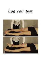 Image result for Pelvic Compression Test