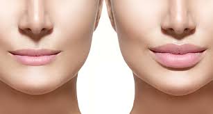 One common issue for 75% of americans over the age of 60 is. Cosmetic Surgery Medicine Britannica
