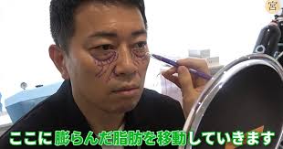 The site owner hides the web page description. ç›®ãƒ'ãƒƒãƒãƒªã§ã™ å®®è¿«åšä¹‹ æœ€é«˜é›£åº¦ã®ç¾Žå®¹æ•´å½¢ã‚'æ±ºè¡Œ ã‚¯ã‚¹ãƒªç–'æƒ'ã‚‚ãŸã‚ŒãŸã‚¯ãƒžã‚„ã»ã†ã‚Œã„ç·šã®ä¸€æŽƒã§ åˆ¥è¿« ã« 1 2 ãƒšãƒ¼ã‚¸ ã­ã¨ã‚‰ã¼