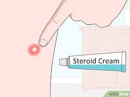 But if you keep constant plucking & pulling, then it could eventually kill the hair follicle on the scalp. 3 Ways To Remove An Ingrown Hair Wikihow
