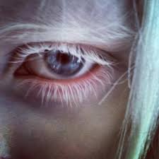 albino albino eyes aesthetic