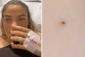 Two women suffered fits after being 'spiked with needle' in York pub