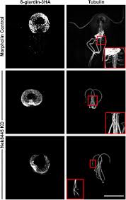 See more of joh melok on facebook. Nek8445 A Protein Kinase Required For Microtubule Regulation And Cytokinesis In Giardia Lamblia Molecular Biology Of The Cell