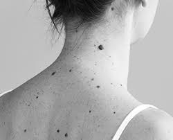 Maybe you would like to learn more about one of these? Ablation Des Cancers De La Peau A Paris 16 Dr Marchac Chirurgie Reparatrice