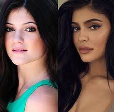 After a prolonged period of denial, kylie finally came clean about her lip injections in an episode of life of kylie. Kylie Jenner Transformation In 2021 Kylie Jenner Nose Kylie Jenner Plastic Surgery Kylie Jenner Transformation