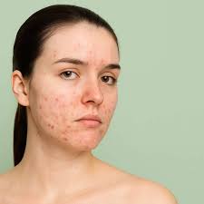 البصراط وخير ما فيها