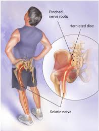 Are You Having Shooting Pain Down Your Leg Here S What You Should Do About It By Betterpt Medium