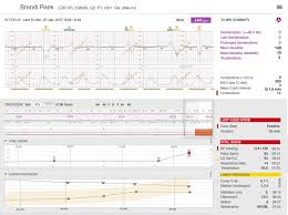 early warning systems in obstetrics periwatch vigilance