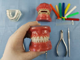 Le mascherine invisalign consentono di correggere i denti storti senza gli ingombri e i fastidi di un normale apparecchio. Invisalign E Apparecchio Fisso La Risposta A Tutte Le Domande My Smile Routine