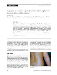 Pityriasis alba most commonly occurs in children with dark skin and involves white, slightly raised patches on the face. Pdf Progressive And Extensive Hypomelanosis And Extensive Pityriasis Alba Same Disease Different Names Vito Di Lernia Academia Edu