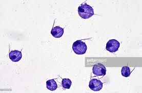 Image result for trichomonas images