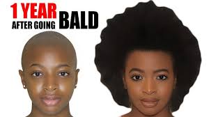 Can shampoo really promote hair growth? 1 Year Hair Growth Journey After Big Chopping And Shaving My Head Bald Time Lapse Footage Youtube
