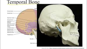 Image result for Temporal Bone
