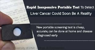 We did not find results for: Health Tip On Detection Of Liver Cancer Possible With Rapid Home Blood Test