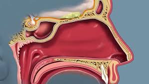 The nasal cavity lies above the bone that forms the roof of the mouth and curves down at the back to join the throat. Olfactory Receptor Anatomy Britannica