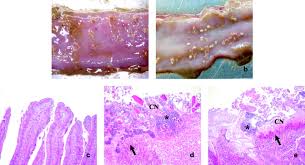 We did not find results for: Alpha Toxin Of Clostridium Perfringens Is Not An Essential Virulence Factor In Necrotic Enteritis In Chickens Infection And Immunity