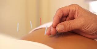 Acupuncture Ubud Radiantly Alive Yoga