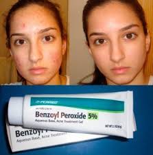 Aziza Mohammed (aziza_mohammed)