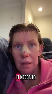 Help please! How do I cover my incisions? I can't miss the service it ...