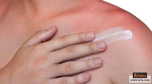 الغابة ودي يقتل طريقة تنظيف الحروق من الدرجة الثانية comertinsaat com