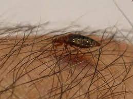 Jan 13, 2021 · at first, i thought i had bed bugs, but after reading more about them, the bites look different, and i cannot find any on my mattress or bed. Can Bed Bugs Live In Your Hair Gross Pestseek