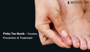 Treatment for numbness in big toe. Pinky Toe Numb Causes Prevention Treatment