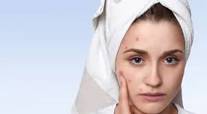Maybe you would like to learn more about one of these? 5 Cara Menyembuhkan Blind Pimple Yang Meradang Beauty Fimela Com