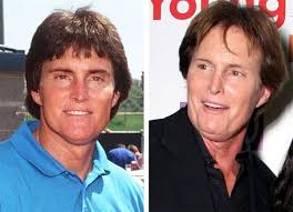 America decided to give this weirdo a hero award (the arthur ashe hero award) over a. 10 Worst Celebrity Plastic Surgeries Botox Jobs Plastische Chirurgie Plastic Surgery Fail Promis