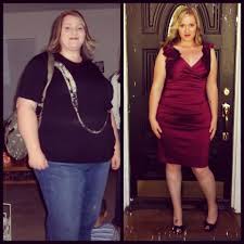 Pin On Bariatric
