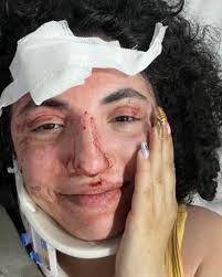 Canadian Solidarity with Palestine