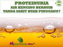 Hint &, tips perkongsian pengalaman tentang 16 gejala sakit buah pinggang yang telah dialami sendiri ketika mula mula disahkan mengidap penyakit kegagalan. Air Kencing Berbuih Dan Proteinuria Tanda Sakit Buah Pinggang Apa Punca Dan Cara Rawat Proteinuria Coach Bisnes Coach Detox Kurus Coach Penyusuan Susu Ibu Mentor Bisnes Pengedar Shaklee Pengedar Youth Pengedar Vivix 011 17547669