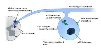 As one of easy natural home remedies for neuropathy, you can take warm bath to relieve mild nerve pain. Cancers Free Full Text Management Of Oxaliplatin Induced Peripheral Sensory Neuropathy Html
